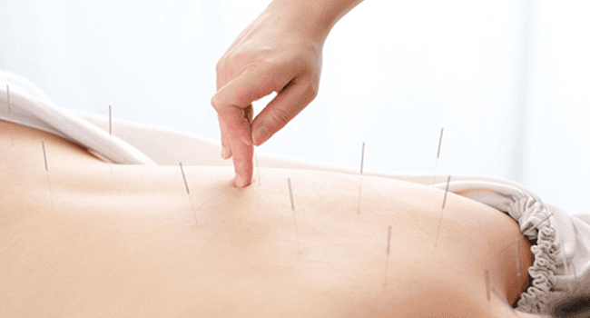 鍼治療
